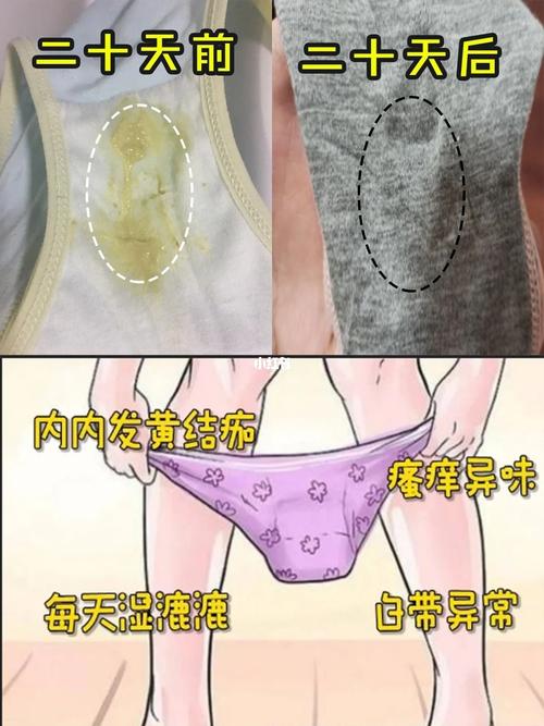 內褲弄成一條線摩擦會怎么樣